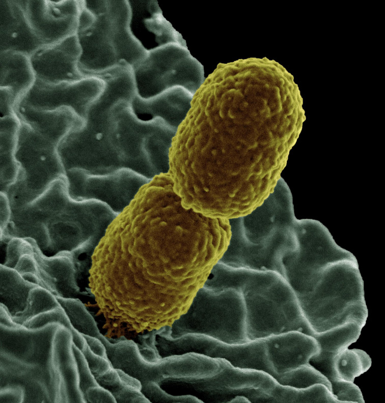 Bacteria muy resistente causa ya miles de muertos en los quirófanos de Europa