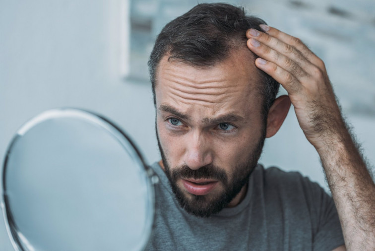 ¿Está relacionada la Covid con la caída del cabello? Especialistas de Vithas Vigo respaldan esta tesis